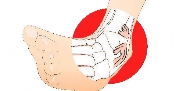 踝關(guān)節(jié)扭傷后的最佳應(yīng)對(duì)指南：簡(jiǎn)單四步，助力快速康復(fù)！
